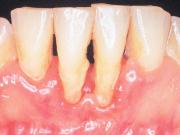 一般歯科/歯周病治療